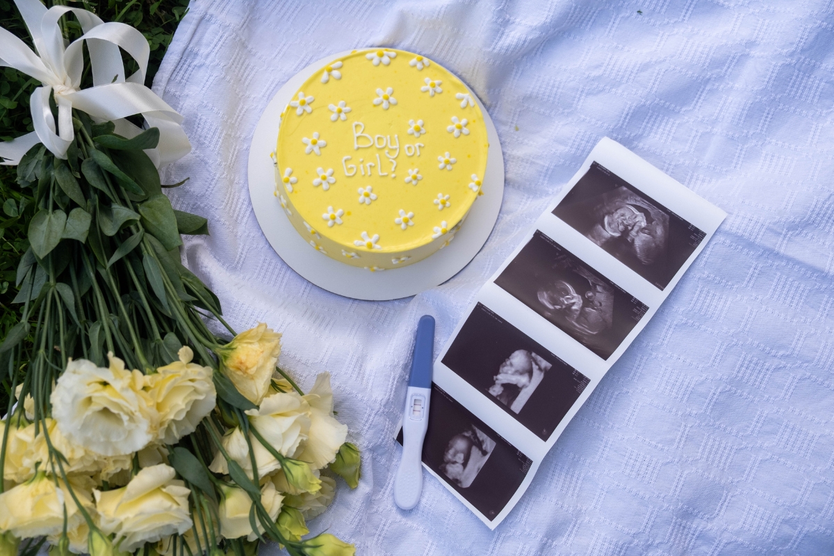 prikaz žute torte na kojoj piše dečak ili devojčica, testa za trudnoću i snimaka bebe sa ultrazvuka